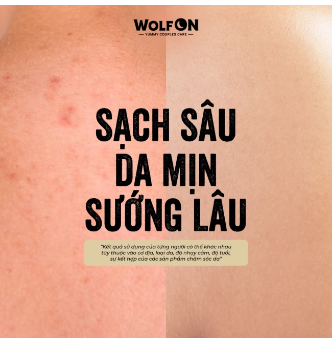 Sữa Tắm Nam Giới 2IN1 Tẩy Tế Bào Chết Wolf ON Shower Scrub Gin 69 Sạch Sâu, Mịn Da, Giảm Mụn 50ml, 350ml
